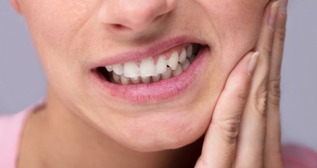 Diş Ağrısına Ne İyi Gelir? Diş Ağrısı Evde Tedavi ile İlaçsız Nasıl Geçer?