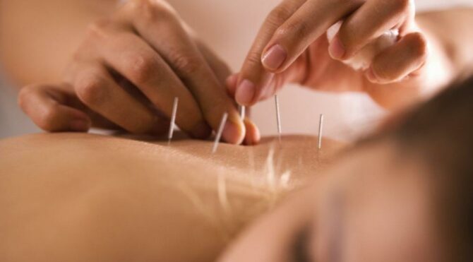 akupunkturun-hamile-kadinlarda-agriyi-azalttigi-bulundu